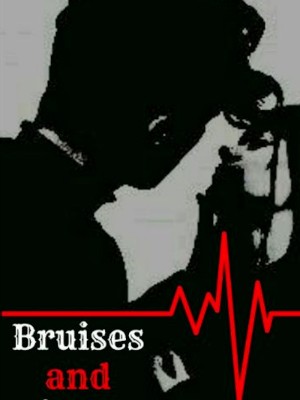 Bruises and Bitemarks